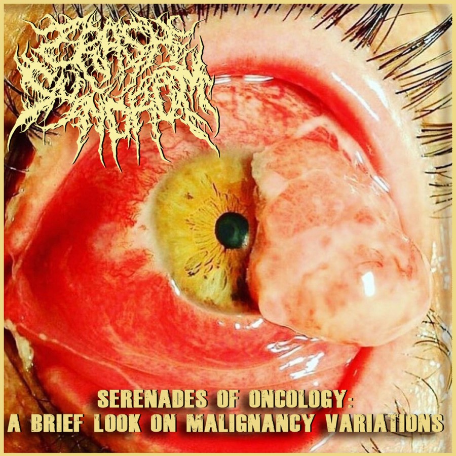 Cannibe / Crash Syndrom - Serenades Of Oncology : A Brief Look On Malignancy Variations (Cd)