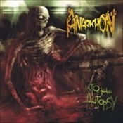 Anarkhon - Into The Autopsy (Cd - Jewel Case)