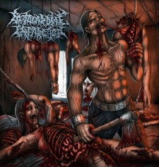 Myocardial Infarction - Single (Cd)