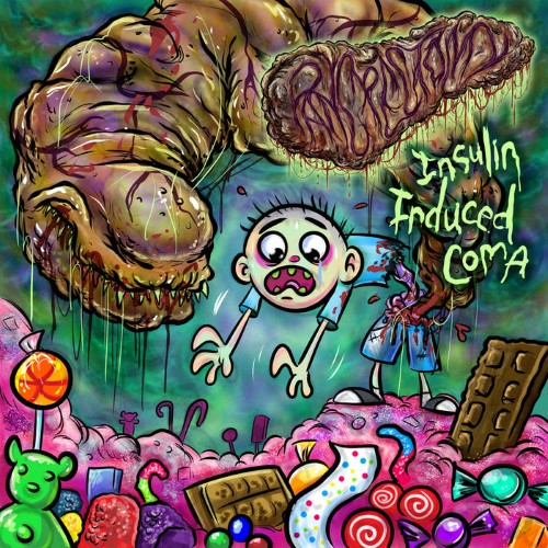 Pancrectomy - Insulin Induced Coma (Mcd)