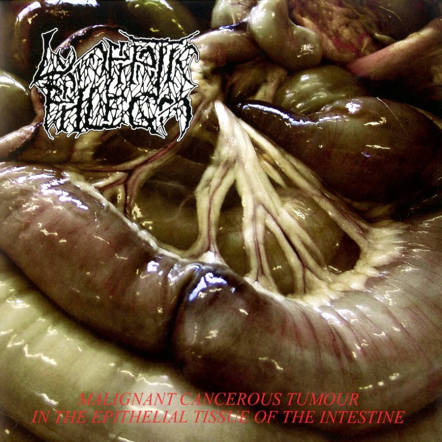 Lymphatic Phlegm / Flesh Grinder - Malignant Cancerous Tumour In The Epithelial Tissue Of The Intestine / From Rotten Process? To Anatomy (12" Lp On Black Vinyl)