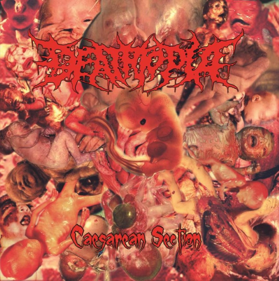 Deathtopia - Caesarean Section (12" Lp On Black Vinyl)